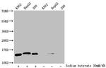 2-hydroxyisobutyryl-Histone H2B (Lys108) Antibody in Western Blot (WB)