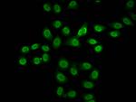Formyl-Histone H2B (Lys116) Antibody in Immunocytochemistry (ICC/IF)
