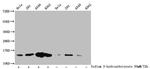 beta-hydroxybutyryl-Histone H2B (Lys11) Antibody in Western Blot (WB)