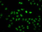 H2BK11cr Antibody in Immunocytochemistry (ICC/IF)
