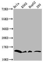 H2BK11cr Antibody in Western Blot (WB)