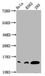 H2BK12cr Antibody in Western Blot (WB)