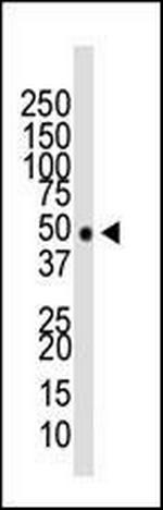 HDAC11 Antibody in Western Blot (WB)