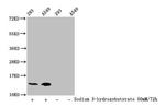 beta-hydroxybutyryl-Histone H2B (Lys20) Antibody in Western Blot (WB)