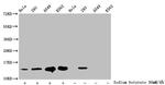 2-hydroxyisobutyryl-Histone H2B (Lys20) Antibody in Western Blot (WB)