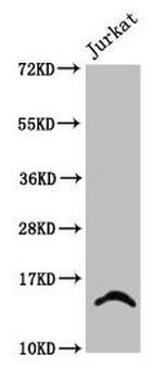 2-hydroxyisobutyryl-Histone H2B (Lys24) Antibody in Western Blot (WB)