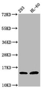 Hydroxyl-Histone H2B (Tyr37) Antibody in Western Blot (WB)