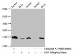 Phospho-Histone H3 (Thr3) Antibody in Western Blot (WB)