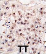 HDAC11 Antibody in Immunohistochemistry (Paraffin) (IHC (P))