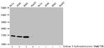 beta-hydroybutyryl-Histone H3 (Lys4) Antibody in Western Blot (WB)