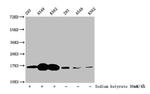2-hydroxyisobutyryl-Histone H3 (Lys4) Antibody in Western Blot (WB)