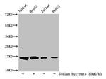 2-hydroxyisobutyryl-Histone H3 (Lys122) Antibody in Western Blot (WB)