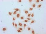 beta-hydroxybutyryl-Histone H3 (Lys18) Antibody in Immunocytochemistry (ICC/IF)