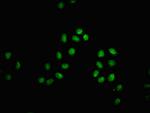 beta-hydroxybutyryl-Histone H3 (Lys18) Antibody in Immunocytochemistry (ICC/IF)