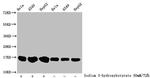 beta-hydroxybutyryl-Histone H3 (Lys18) Antibody in Western Blot (WB)