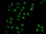 Butyryl-Histone H3 (Lys18) Antibody in Immunocytochemistry (ICC/IF)