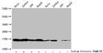Butyryl-Histone H3 (Lys18) Antibody in Western Blot (WB)
