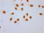 2-hydroxyisobutyryl-Histone H3 (Lys18) Antibody in Immunocytochemistry (ICC/IF)