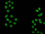 2-hydroxyisobutyryl-Histone H3 (Lys18) Antibody in Immunocytochemistry (ICC/IF)