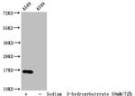 beta-hydroxybutyryl-Histone H3 (Lys23) Antibody in Western Blot (WB)