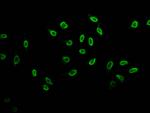 Butyryl-Histone H3 (Lys23) Antibody in Immunocytochemistry (ICC/IF)