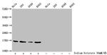 Butyryl-Histone H3 (Lys23) Antibody in Western Blot (WB)