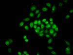 Formyl-Histone H3 (Lys23) Antibody in Immunocytochemistry (ICC/IF)