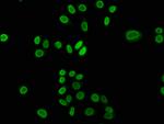 2-hydroxyisobutyryl-Histone H3 (Lys23) Antibody in Immunocytochemistry (ICC/IF)