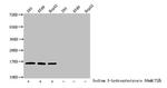 beta-hydroxybutyryl-Histone H3 (Lys27) Antibody in Western Blot (WB)