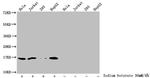 Butyryl-Histone H3 (Lys27) Antibody in Western Blot (WB)