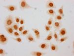 2-hydroxyisobutyryl-Histone H3 (Lys27) Antibody in Immunocytochemistry (ICC/IF)