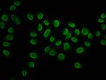 2-hydroxyisobutyryl-Histone H3 (Lys27) Antibody in Immunocytochemistry (ICC/IF)