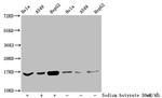 2-hydroxyisobutyryl-Histone H3 (Lys27) Antibody in Western Blot (WB)