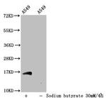 H3K56ac Polyclonal Antibody