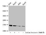 H3K56mal Polyclonal Antibody