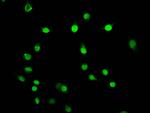 beta-hydroxybutyryl-Histone H3 (Lys79) Antibody in Immunocytochemistry (ICC/IF)