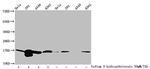 beta-hydroxybutyryl-Histone H3 (Lys79) Antibody in Western Blot (WB)
