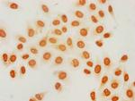 2-hydroxyisobutyryl-Histone H3 (Lys18) Antibody in Immunocytochemistry (ICC/IF)