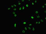 2-hydroxyisobutyryl-Histone H3 (Lys18) Antibody in Immunocytochemistry (ICC/IF)