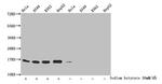 2-hydroxyisobutyryl-Histone H3 (Lys18) Antibody in Western Blot (WB)