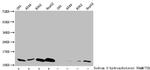 beta-hydroxybutyryl-Histone H4 (Lys5) Antibody in Western Blot (WB)