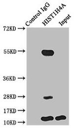 Butyryl-Histone H4 (Lys5) Antibody in Immunoprecipitation (IP)