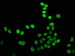 H4K8cr Antibody in Immunocytochemistry (ICC/IF)