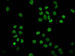 Butyryl-Histone H4 (Lys12) Antibody in Immunocytochemistry (ICC/IF)