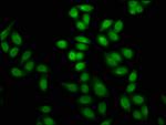 Formyl-Histone H4 (Lys12) Antibody in Immunocytochemistry (ICC/IF)