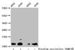 Succinyl-Histone H4 (Lys12) Antibody in Western Blot (WB)
