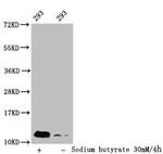 2-hydroxyisobutyryl-Histone H4 (Lys31) Antibody in Western Blot (WB)