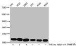 2-hydroxyisobutyryl-Histone H4 (Lys77) Antibody in Western Blot (WB)