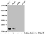 Formyl-Histone H4 (Lys79) Antibody in Western Blot (WB)