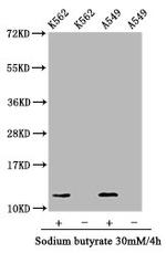 Hydroxyl-Histone H4 (Tyr88) Antibody in Western Blot (WB)